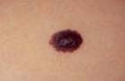 Mole