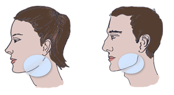 jaw reduction 2.PNG (489×267)