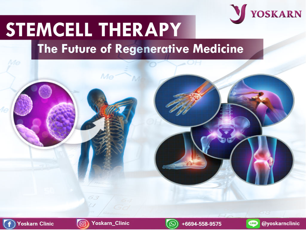stem cell therapy Thailand