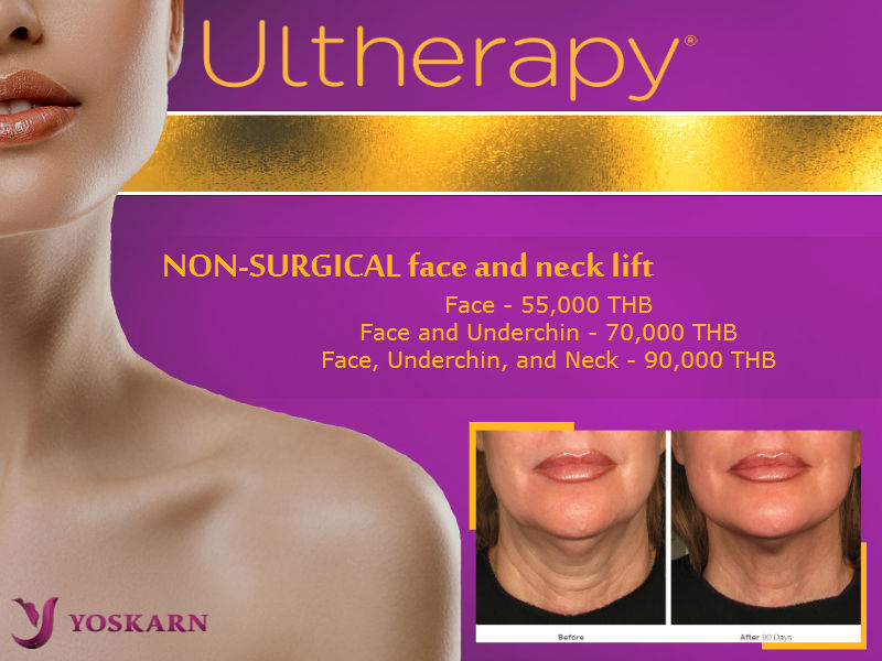 Ulthera Bangkok, non-surgical facelift Thailand